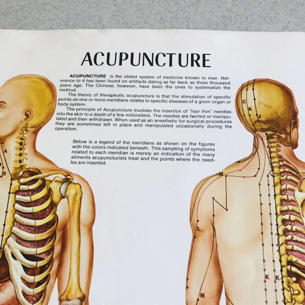 Acupuncture Medical Wall Chart 1973 Anatomical Chart Co. Chi., IL Diane Nelson  Illustrator doctor's office hospital collectible training