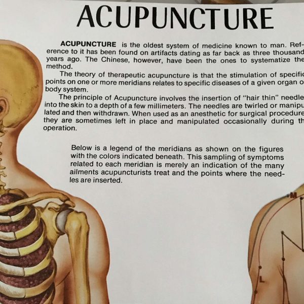 Acupuncture Medical Wall Chart 1973 Anatomical Chart Co. Chi., IL Diane Nelson  Illustrator doctor's office hospital collectible training