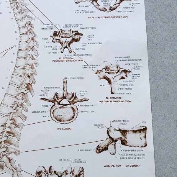 Vertebral Column Medical Wall Chart 1980 Anatomical Chart Co. Chi., IL Diane Nelson  Illustrator doctor's office hospital collectible